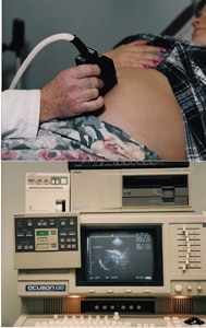 17481 7f0ed6d3 6d0b 4a86 bd72 a575ff3250c9 ecografia